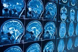 The Adaptable Brain Structures and Function