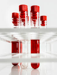 Intro to Blood & Blood Typing
